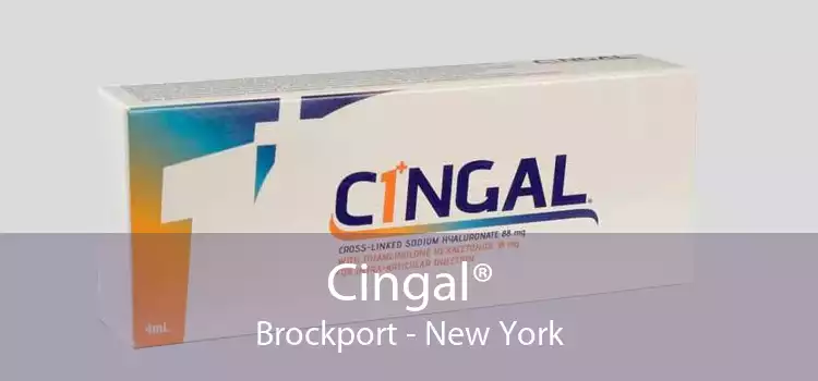 Cingal® Brockport - New York
