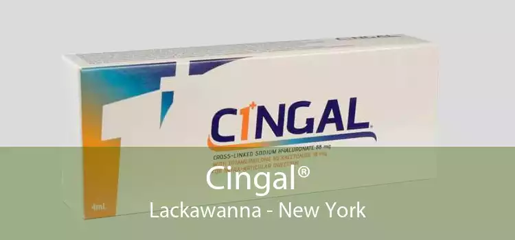 Cingal® Lackawanna - New York