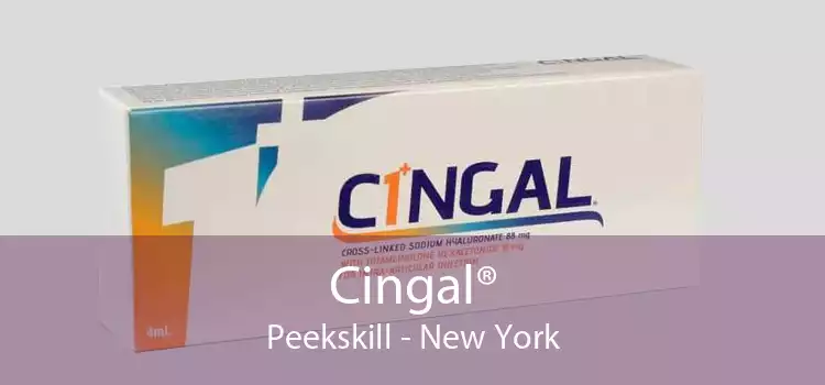 Cingal® Peekskill - New York