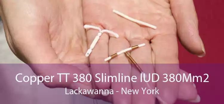 Copper TT 380 Slimline IUD 380Mm2 Lackawanna - New York