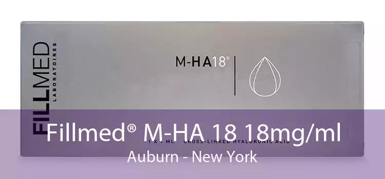 Fillmed® M-HA 18 18mg/ml Auburn - New York