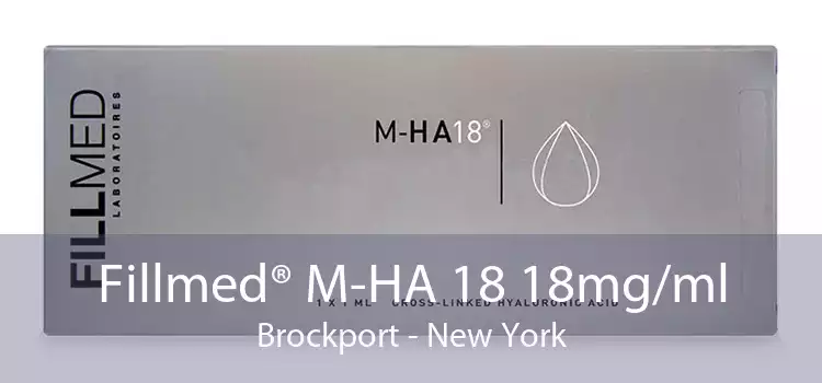 Fillmed® M-HA 18 18mg/ml Brockport - New York