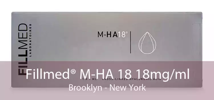 Fillmed® M-HA 18 18mg/ml Brooklyn - New York