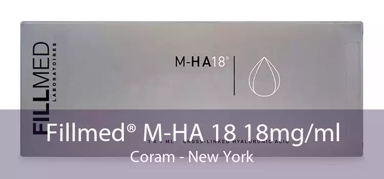Fillmed® M-HA 18 18mg/ml Coram - New York