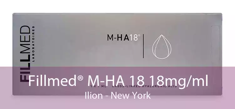 Fillmed® M-HA 18 18mg/ml Ilion - New York