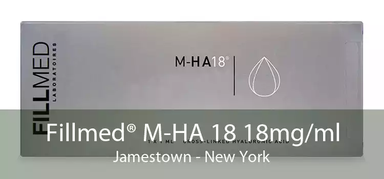 Fillmed® M-HA 18 18mg/ml Jamestown - New York