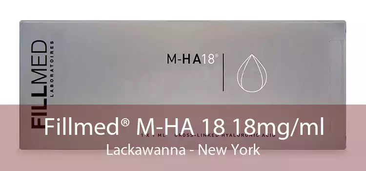 Fillmed® M-HA 18 18mg/ml Lackawanna - New York