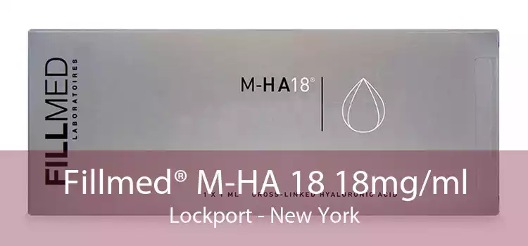 Fillmed® M-HA 18 18mg/ml Lockport - New York