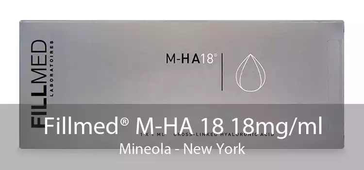 Fillmed® M-HA 18 18mg/ml Mineola - New York