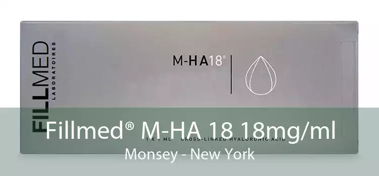Fillmed® M-HA 18 18mg/ml Monsey - New York