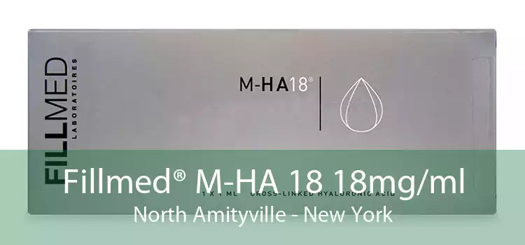 Fillmed® M-HA 18 18mg/ml North Amityville - New York