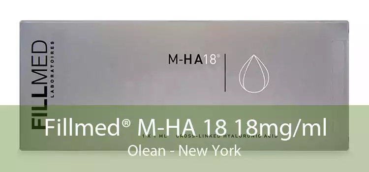 Fillmed® M-HA 18 18mg/ml Olean - New York