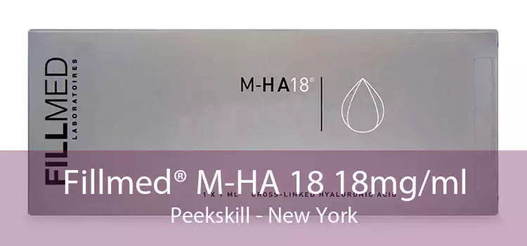 Fillmed® M-HA 18 18mg/ml Peekskill - New York