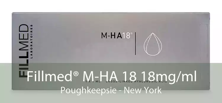 Fillmed® M-HA 18 18mg/ml Poughkeepsie - New York