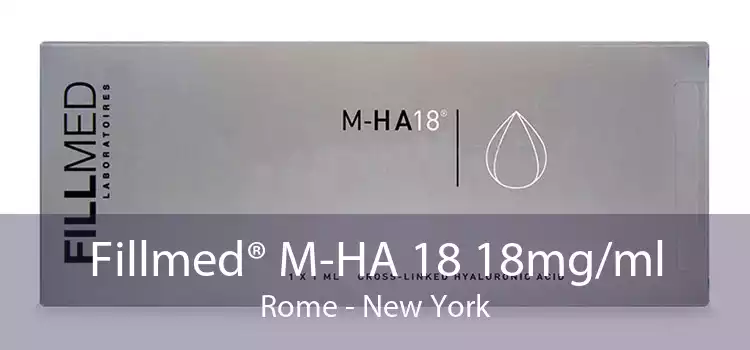 Fillmed® M-HA 18 18mg/ml Rome - New York