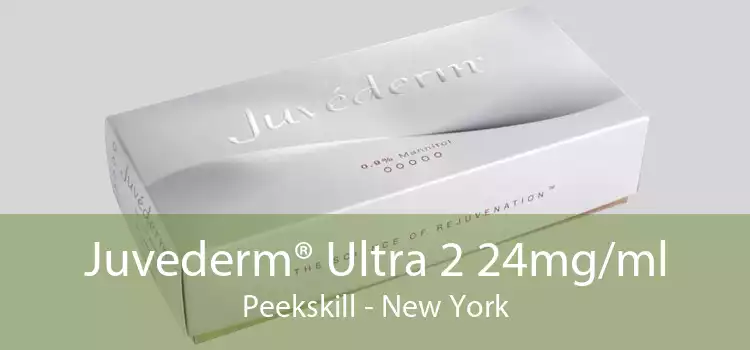 Juvederm® Ultra 2 24mg/ml Peekskill - New York