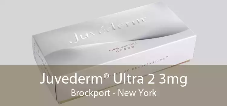 Juvederm® Ultra 2 3mg Brockport - New York