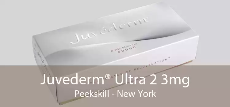 Juvederm® Ultra 2 3mg Peekskill - New York