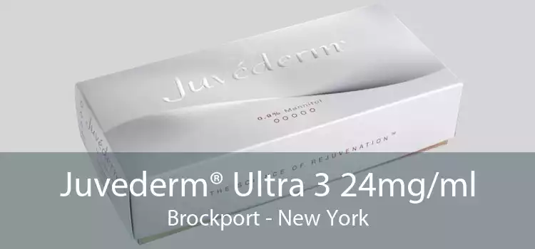 Juvederm® Ultra 3 24mg/ml Brockport - New York