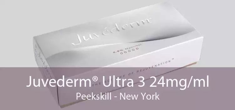 Juvederm® Ultra 3 24mg/ml Peekskill - New York
