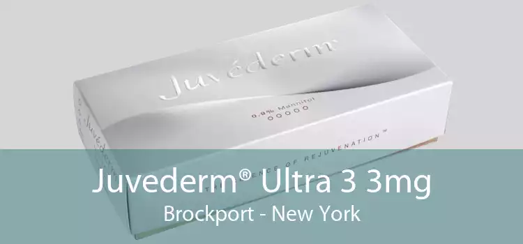 Juvederm® Ultra 3 3mg Brockport - New York