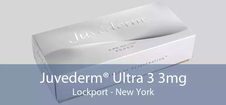Juvederm® Ultra 3 3mg Lockport - New York