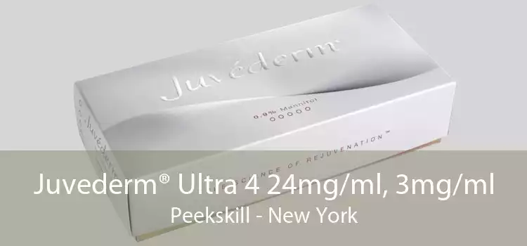 Juvederm® Ultra 4 24mg/ml, 3mg/ml Peekskill - New York
