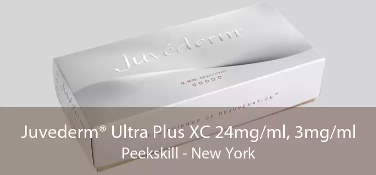 Juvederm® Ultra Plus XC 24mg/ml, 3mg/ml Peekskill - New York
