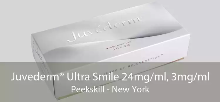 Juvederm® Ultra Smile 24mg/ml, 3mg/ml Peekskill - New York