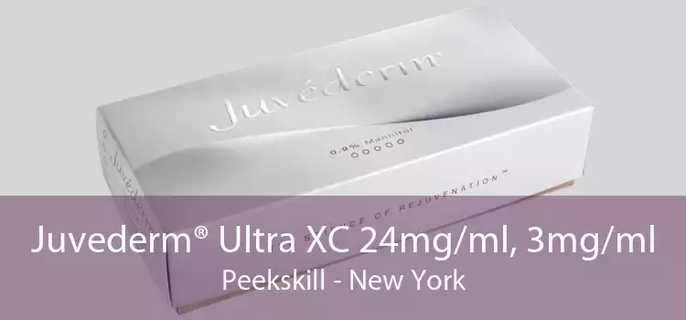 Juvederm® Ultra XC 24mg/ml, 3mg/ml Peekskill - New York