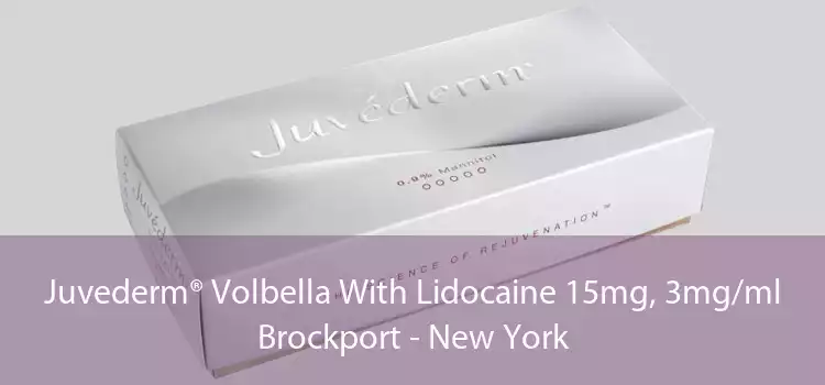 Juvederm® Volbella With Lidocaine 15mg, 3mg/ml Brockport - New York