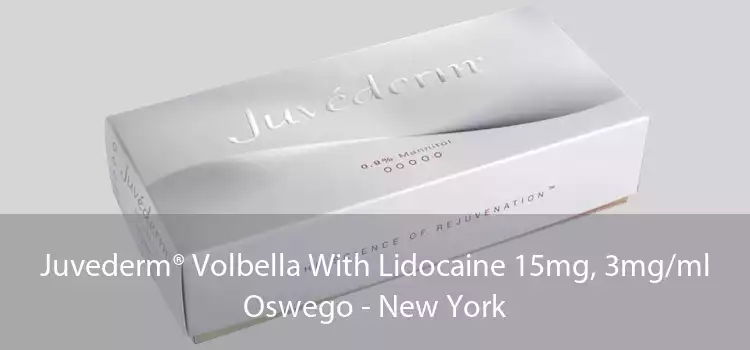 Juvederm® Volbella With Lidocaine 15mg, 3mg/ml Oswego - New York