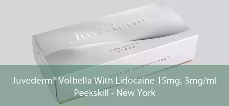 Juvederm® Volbella With Lidocaine 15mg, 3mg/ml Peekskill - New York