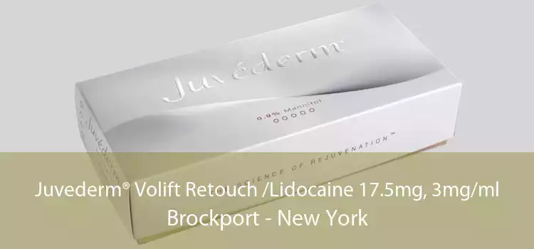 Juvederm® Volift Retouch /Lidocaine 17.5mg, 3mg/ml Brockport - New York