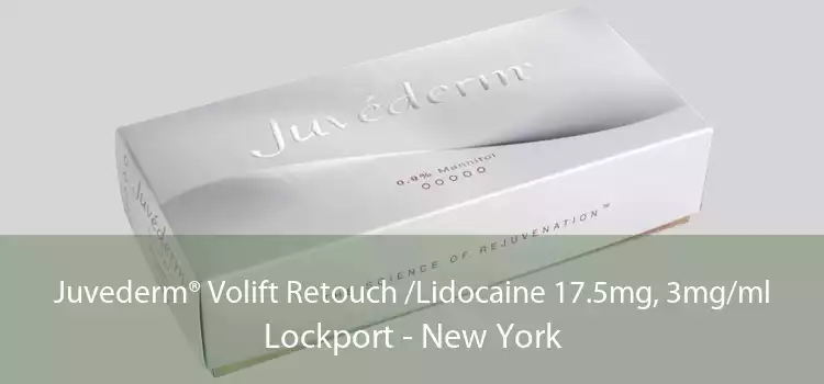 Juvederm® Volift Retouch /Lidocaine 17.5mg, 3mg/ml Lockport - New York