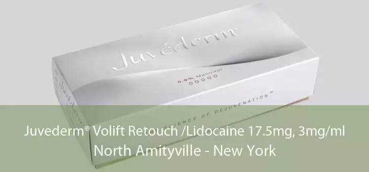 Juvederm® Volift Retouch /Lidocaine 17.5mg, 3mg/ml North Amityville - New York