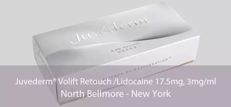 Juvederm® Volift Retouch /Lidocaine 17.5mg, 3mg/ml North Bellmore - New York
