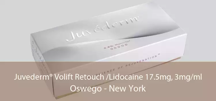 Juvederm® Volift Retouch /Lidocaine 17.5mg, 3mg/ml Oswego - New York