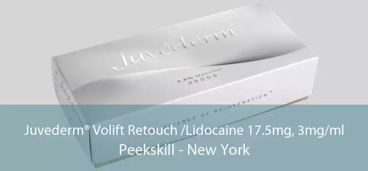 Juvederm® Volift Retouch /Lidocaine 17.5mg, 3mg/ml Peekskill - New York