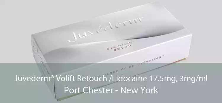 Juvederm® Volift Retouch /Lidocaine 17.5mg, 3mg/ml Port Chester - New York
