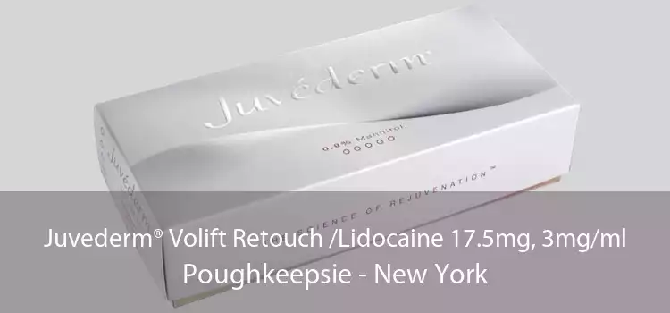 Juvederm® Volift Retouch /Lidocaine 17.5mg, 3mg/ml Poughkeepsie - New York