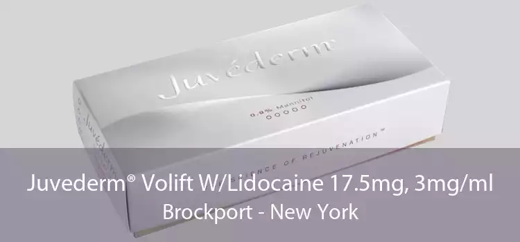 Juvederm® Volift W/Lidocaine 17.5mg, 3mg/ml Brockport - New York