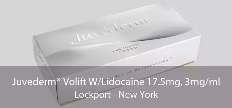 Juvederm® Volift W/Lidocaine 17.5mg, 3mg/ml Lockport - New York
