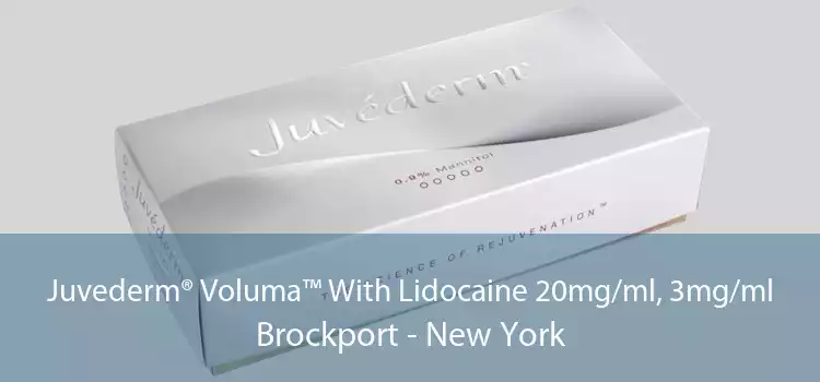 Juvederm® Voluma™ With Lidocaine 20mg/ml, 3mg/ml Brockport - New York