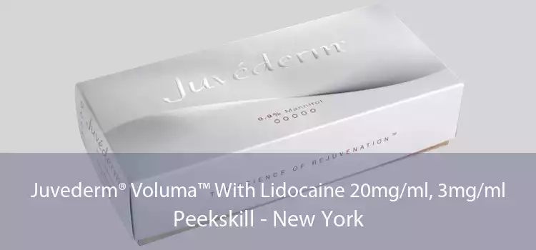 Juvederm® Voluma™ With Lidocaine 20mg/ml, 3mg/ml Peekskill - New York