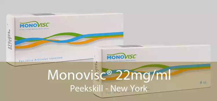 Monovisc® 22mg/ml Peekskill - New York