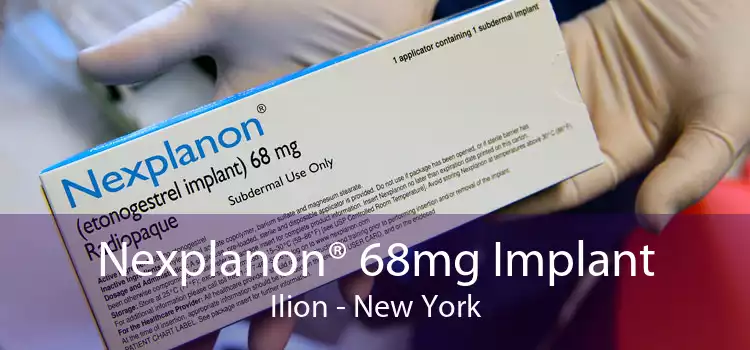 Nexplanon® 68mg Implant Ilion - New York