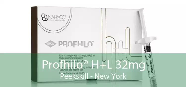 Profhilo® H+L 32mg Peekskill - New York