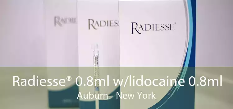 Radiesse® 0.8ml w/lidocaine 0.8ml Auburn - New York