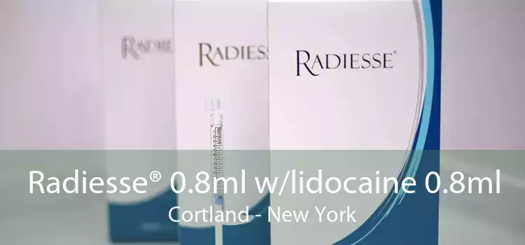 Radiesse® 0.8ml w/lidocaine 0.8ml Cortland - New York